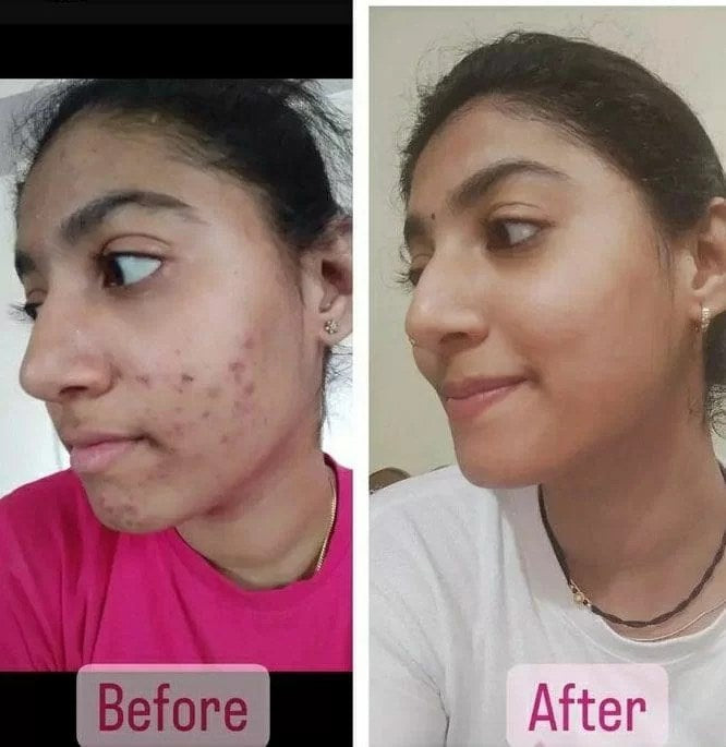 Pearl Facial Clear & Glow Best Results In 20 Mints