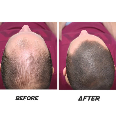 Hair care Oil 100% Organic 200 ML Big Size